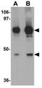 Regulator Of Microtubule Dynamics 2 antibody, GTX85107, GeneTex, Western Blot image 