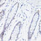 Estrogen Related Receptor Alpha antibody, LS-C749195, Lifespan Biosciences, Immunohistochemistry paraffin image 