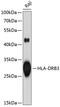 Major Histocompatibility Complex, Class II, DR Beta 3 antibody, GTX54087, GeneTex, Western Blot image 