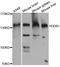 Damage Specific DNA Binding Protein 1 antibody, orb135377, Biorbyt, Western Blot image 