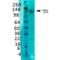Solute Carrier Family 12 Member 5 antibody, SMC-392D-PCP, StressMarq, Western Blot image 