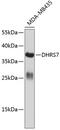 Dehydrogenase/Reductase 7 antibody, 14-606, ProSci, Western Blot image 