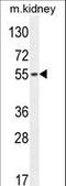 F-Box Protein 39 antibody, LS-B12066, Lifespan Biosciences, Western Blot image 
