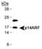 Cyclin Dependent Kinase Inhibitor 2A antibody, NB110-59085, Novus Biologicals, Western Blot image 