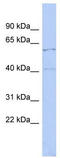 Zinc Finger Protein 384 antibody, TA329348, Origene, Western Blot image 