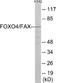 Forkhead Box O4 antibody, EKC1926, Boster Biological Technology, Western Blot image 