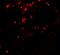 BMP And Activin Membrane Bound Inhibitor antibody, A07983, Boster Biological Technology, Immunofluorescence image 
