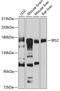 Insulin receptor substrate 2 antibody, 23-299, ProSci, Western Blot image 
