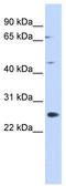 Spermatogenesis Associated 22 antibody, TA344245, Origene, Western Blot image 