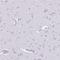 IK1 antibody, HPA035221, Atlas Antibodies, Immunohistochemistry frozen image 