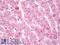 c-met antibody, LS-B8031, Lifespan Biosciences, Immunohistochemistry frozen image 