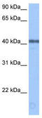 DNA dC->dU-editing enzyme APOBEC-3F antibody, TA345716, Origene, Western Blot image 