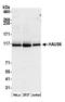 HAUS augmin-like complex subunit 6 antibody, A305-458A, Bethyl Labs, Western Blot image 