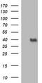 Uracil Phosphoribosyltransferase Homolog antibody, TA506867AM, Origene, Western Blot image 
