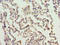 ERCC Excision Repair 6 Like 2 antibody, orb22966, Biorbyt, Immunohistochemistry paraffin image 