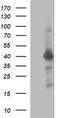 Uracil Phosphoribosyltransferase Homolog antibody, TA506869S, Origene, Western Blot image 