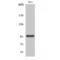 Plakophilin 2 antibody, LS-C385548, Lifespan Biosciences, Western Blot image 