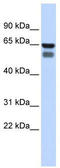 Polypeptide N-Acetylgalactosaminyltransferase 4 antibody, TA338209, Origene, Western Blot image 