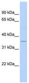 ELOVL Fatty Acid Elongase 5 antibody, TA338477, Origene, Western Blot image 