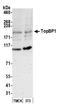 DNA Topoisomerase II Binding Protein 1 antibody, A300-111A, Bethyl Labs, Western Blot image 