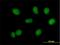 RecQ Mediated Genome Instability 1 antibody, H00080010-B02P, Novus Biologicals, Immunofluorescence image 