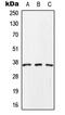 Secretory carrier-associated membrane protein 1 antibody, MBS821027, MyBioSource, Western Blot image 