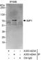 Insulin Like Growth Factor 2 MRNA Binding Protein 1 antibody, A303-424A, Bethyl Labs, Immunoprecipitation image 