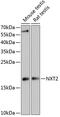 Nuclear Transport Factor 2 Like Export Factor 2 antibody, 15-219, ProSci, Western Blot image 