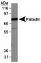 Palladin, Cytoskeletal Associated Protein antibody, TA309787, Origene, Western Blot image 