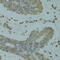 Diacylglycerol Kinase Theta antibody, 19-175, ProSci, Immunohistochemistry paraffin image 