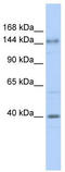 ADCYA antibody, TA342378, Origene, Western Blot image 