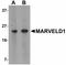 Putative MARVEL domain-containing protein 1 antibody, LS-C108629, Lifespan Biosciences, Western Blot image 
