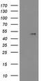 Platelet Derived Growth Factor D antibody, M01875, Boster Biological Technology, Western Blot image 