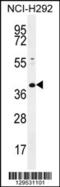 Potassium Channel Tetramerization Domain Containing 2 antibody, 55-892, ProSci, Western Blot image 