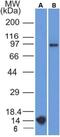 Follicle Stimulating Hormone Receptor antibody, NBP2-36489, Novus Biologicals, Western Blot image 