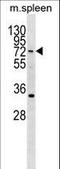 Hypermethylated in cancer 2 protein antibody, LS-C159832, Lifespan Biosciences, Western Blot image 