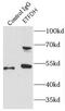 Electron transfer flavoprotein-ubiquinone oxidoreductase, mitochondrial antibody, FNab02877, FineTest, Immunoprecipitation image 