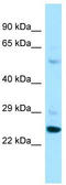 Prolyl-TRNA Synthetase 2, Mitochondrial antibody, TA334344, Origene, Western Blot image 