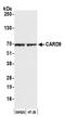 Caspase Recruitment Domain Family Member 9 antibody, A305-878A-M, Bethyl Labs, Western Blot image 