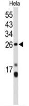 Centromere Protein H antibody, GTX80491, GeneTex, Western Blot image 