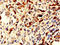 NHP2 Ribonucleoprotein antibody, LS-C397375, Lifespan Biosciences, Immunohistochemistry paraffin image 