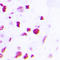 CCAAT Enhancer Binding Protein Beta antibody, LS-C351992, Lifespan Biosciences, Immunohistochemistry paraffin image 