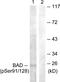 BCL2 Associated Agonist Of Cell Death antibody, AP55717PU-N, Origene, Western Blot image 