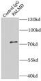 Palmdelphin antibody, FNab06128, FineTest, Immunoprecipitation image 