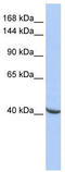 Pogo Transposable Element Derived With ZNF Domain antibody, TA331640, Origene, Western Blot image 
