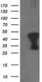 Tropomodulin 1 antibody, MA5-25606, Invitrogen Antibodies, Western Blot image 