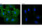 EPH Receptor A2 antibody, 6997T, Cell Signaling Technology, Immunocytochemistry image 