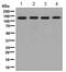 Structural Maintenance Of Chromosomes 3 antibody, ab128919, Abcam, Western Blot image 