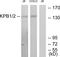 Phosphorylase Kinase Regulatory Subunit Alpha 1 antibody, LS-C118899, Lifespan Biosciences, Western Blot image 