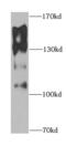 Glutamyl Aminopeptidase antibody, FNab02772, FineTest, Western Blot image 